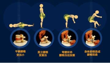 中风后偏瘫康复训练：循序渐进比盲目加量更重要